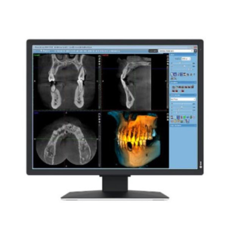 Eizo Radiforce MX217-SB